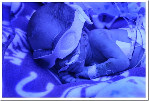 Henry Samuel Murray (cq), bathed in blue ultraviolet light in the NICU at St. Vincent Women's Hospital, Friday, February 9, 2007,  was the first in a set of quadruplets born to Jen and Brad Murray last Friday, February 2, 2007.  He was 2 lbs 11 ozs at birth.    The four brothers are all in the NICU.  (Kelly Wilkinson / The Indianapolis Star)